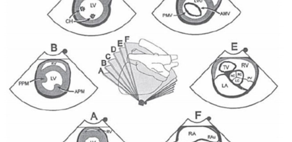 Bases Técnicas e Modalidades Ecocardiográficas