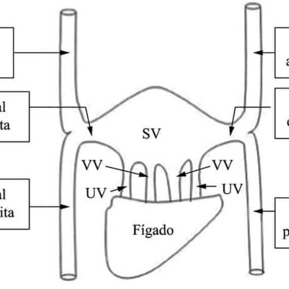 Persistência da Veia Cava Superior Esquerda