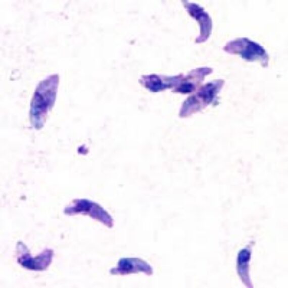 PCR-RFLP no Diagnóstico de Toxoplasma gondii