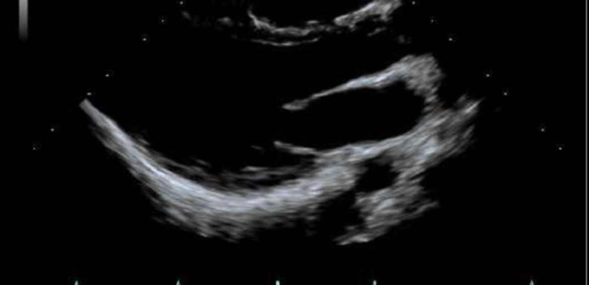 Ajustes na Imagem Ecocardiográfica – Faixa Dinâmica (DR)