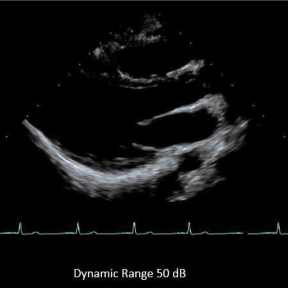 Ajustes na Imagem Ecocardiográfica – Faixa Dinâmica (DR)